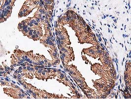 NUDT6 Antibody - IHC of paraffin-embedded Human prostate tissue using anti-NUDT6 mouse monoclonal antibody.