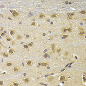 NUDT6 Antibody - Immunohistochemistry of paraffin-embedded rat brain tissue.