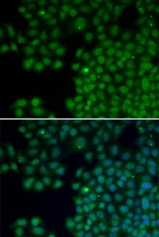 NUDT6 Antibody - Immunofluorescence analysis of HeLa cells using NUDT6 antibody. Blue: DAPI for nuclear staining.