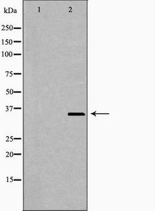 NUDT6 Antibody - Western blot analysis of extracts of Jurkat cells using NUDT6 antibody. The lane on the left is treated with the antigen-specific peptide.