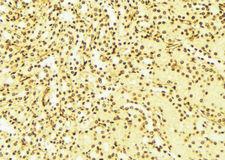 NUDT6 Antibody - 1:100 staining mouse liver tissue by IHC-P. The sample was formaldehyde fixed and a heat mediated antigen retrieval step in citrate buffer was performed. The sample was then blocked and incubated with the antibody for 1.5 hours at 22°C. An HRP conjugated goat anti-rabbit antibody was used as the secondary.