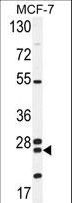 NUDT8 Antibody - NUDT8 Antibody western blot of MCF-7 cell line lysates (35 ug/lane). The NUDT8 antibody detected the NUDT8 protein (arrow).