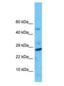 NUDT8 Antibody - NUDT8 antibody Western Blot of HepG2. Antibody dilution: 1 ug/ml.  This image was taken for the unconjugated form of this product. Other forms have not been tested.