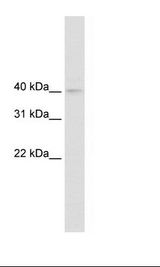 NUDT9 Antibody - Fetal kidney Lysate.  This image was taken for the unconjugated form of this product. Other forms have not been tested.