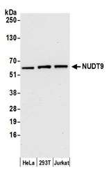 NUDT9 Antibody - Detection of human NUDT9 by western blot. Samples: Whole cell lysate (15 µg) from HeLa, HEK293T, and Jurkat cells prepared using NETN lysis buffer. Antibody: Affinity purified rabbit anti-NUDT9 antibody used for WB at 1:1000. Detection: Chemiluminescence with an exposure time of 30 seconds.