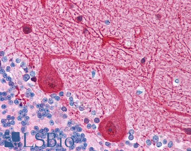 NUDT9 Antibody - Human Brain, Cerebellum (formalin-fixed, paraffin-embedded) stained with NUDT9 antibody LS-B988 at 2.5 ug/ml followed by biotinylated goat anti-rabbit IgG secondary antibody, alkaline phosphatase-streptavidin and chromogen.  This image was taken for the unconjugated form of this product. Other forms have not been tested.
