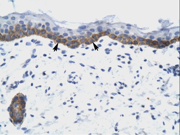 NUDT9 Antibody - Human Skin.  This image was taken for the unconjugated form of this product. Other forms have not been tested.