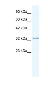 NUDT9 Antibody - NUDT9 antibody Western blot of Jurkat lysate. This image was taken for the unconjugated form of this product. Other forms have not been tested.