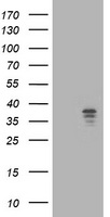 NUDT9 Antibody - HEK293T cells were transfected with the pCMV6-ENTRY control (Left lane) or pCMV6-ENTRY NUDT9 (Right lane) cDNA for 48 hrs and lysed. Equivalent amounts of cell lysates (5 ug per lane) were separated by SDS-PAGE and immunoblotted with anti-NUDT9.