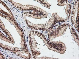 NUDT9 Antibody - IHC of paraffin-embedded Human prostate tissue using anti-NUDT9 mouse monoclonal antibody.