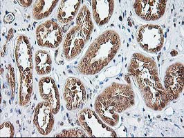 NUDT9 Antibody - IHC of paraffin-embedded Human Kidney tissue using anti-NUDT9 mouse monoclonal antibody.