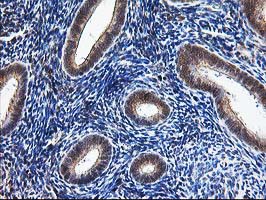 NUDT9 Antibody - IHC of paraffin-embedded Human endometrium tissue using anti-NUDT9 mouse monoclonal antibody.