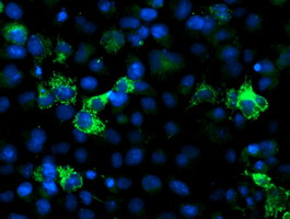 NUDT9 Antibody - Anti-NUDT9 mouse monoclonal antibody immunofluorescent staining of COS7 cells transiently transfected by pCMV6-ENTRY NUDT9.