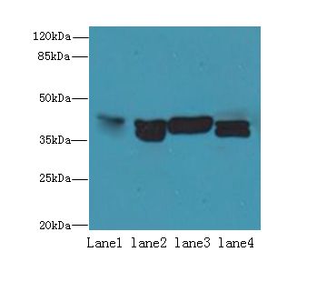 NUDT9 Antibody - Western blot. All lanes: NUDT9 antibody at 8 ug/ml. Lane 1: Raji whole cell lysate. Lane 2: Jurkat whole cell lysate. Lane 3: Mouse kidney tissue. Lane 4: HeLa whole cell lysate. Secondary antibody: Goat polyclonal to Rabbit IgG at 1:10000 dilution. Predicted band size: 39 kDa. Observed band size: 39 kDa.