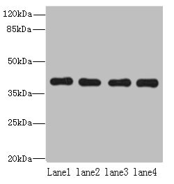 NUDT9 Antibody - Western blot All lanes: NUDT9 antibody at 8µg/ml Lane 1: Raji whole cell lysate Lane 2: Jurkat whole cell lysate Lane 3: Mouse kidney tissue Lane 4: Hela whole cell lysate Secondary Goat polyclonal to rabbit IgG at 1/10000 dilution Predicted band size: 40, 34 kDa Observed band size: 40 kDa