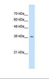 NUDT9 Antibody - HepG2 cell lysate. Antibody concentration: 1.0 ug/ml. Gel concentration: 12%.  This image was taken for the unconjugated form of this product. Other forms have not been tested.