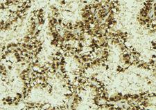 NUFIP1 / NUFIP Antibody - 1:100 staining human lung tissue by IHC-P. The sample was formaldehyde fixed and a heat mediated antigen retrieval step in citrate buffer was performed. The sample was then blocked and incubated with the antibody for 1.5 hours at 22°C. An HRP conjugated goat anti-rabbit antibody was used as the secondary.