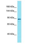 NUGGC Antibody - NUGGC antibody Western Blot of PANC1. Antibody dilution: 1 ug/ml.  This image was taken for the unconjugated form of this product. Other forms have not been tested.