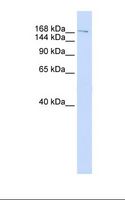 NUMA1 / NUMA Antibody - Fetal lung lysate. Antibody concentration: 1.0 ug/ml. Gel concentration: 6-18%.  This image was taken for the unconjugated form of this product. Other forms have not been tested.