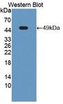 NUMA1 / NUMA Antibody - Western blot of NUMA1 / NUMA antibody.