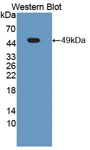 NUMA1 / NUMA Antibody - Western blot of NUMA1 / NUMA antibody.