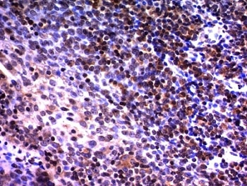 NUMA1 / NUMA Antibody - Formalin-fixed, paraffin-embedded human tonsil stained with NuMA antibody (A73-B/D12).  This image was taken for the unmodified form of this product. Other forms have not been tested.