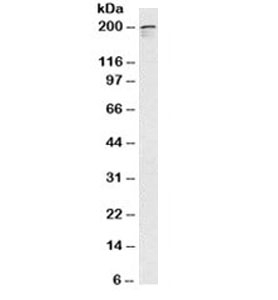 NUMA1 / NUMA Antibody - Western blot testing of MOLT-4 cell lysate (nuclear fraction) with NuMA antibody (clone A73-B/D12).