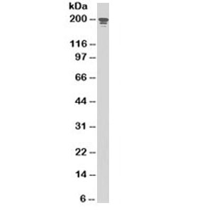 NUMA1 / NUMA Antibody - Western blot testing of MOLT-4 cell lysate (nuclear fraction) with NuMA antibody (clone SPM300). This image was taken for the unmodified form of this product. Other forms have not been tested.