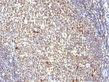 NUMA1 / NUMA Antibody - Formalin-fixed, paraffin-embedded human tonsil stained with NuMA antibody (SPM300).  This image was taken for the unmodified form of this product. Other forms have not been tested.