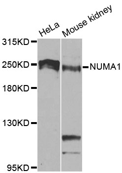 NUMA1 / NUMA Antibody - Western blot analysis of extracts of various cell lines, using NUMA1 antibody at 1:1000 dilution. The secondary antibody used was an HRP Goat Anti-Rabbit IgG (H+L) at 1:10000 dilution. Lysates were loaded 25ug per lane and 3% nonfat dry milk in TBST was used for blocking. An ECL Kit was used for detection and the exposure time was 90s.