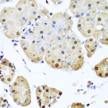 NUMA1 / NUMA Antibody - Immunohistochemistry of paraffin-embedded human stomach using NUMA1 antibodyat dilution of 1:100 (40x lens).