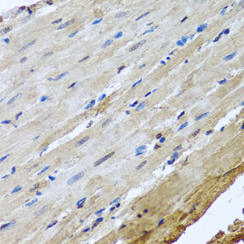 NUMA1 / NUMA Antibody - Immunohistochemistry of paraffin-embedded rat heart using NUMA1 antibodyat dilution of 1:100 (40x lens).