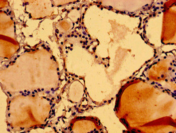 NUMA1 / NUMA Antibody - Immunohistochemistry image of paraffin-embedded human thyroid tissue at a dilution of 1:100