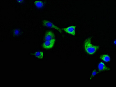 NUMA1 / NUMA Antibody - Immunofluorescence staining of MCF-7 cells with NUMA1 Antibody at 1:133, counter-stained with DAPI. The cells were fixed in 4% formaldehyde, permeabilized using 0.2% Triton X-100 and blocked in 10% normal Goat Serum. The cells were then incubated with the antibody overnight at 4°C. The secondary antibody was Alexa Fluor 488-congugated AffiniPure Goat Anti-Rabbit IgG(H+L).
