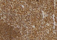 NUMA1 / NUMA Antibody - 1:100 staining mouse spleen tissue by IHC-P. The sample was formaldehyde fixed and a heat mediated antigen retrieval step in citrate buffer was performed. The sample was then blocked and incubated with the antibody for 1.5 hours at 22°C. An HRP conjugated goat anti-rabbit antibody was used as the secondary.