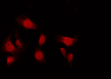 NUMA1 / NUMA Antibody - Staining A549 cells by IF/ICC. The samples were fixed with PFA and permeabilized in 0.1% Triton X-100, then blocked in 10% serum for 45 min at 25°C. The primary antibody was diluted at 1:200 and incubated with the sample for 1 hour at 37°C. An Alexa Fluor 594 conjugated goat anti-rabbit IgG (H+L) Ab, diluted at 1/600, was used as the secondary antibody.