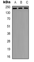 NUMA1 / NUMA Antibody - Western blot analysis of NUMA expression in HeLa (A); A431 (B); A549 (C) whole cell lysates.