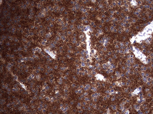 NUMB Antibody - IHC of paraffin-embedded Human embryonic cerebellum using anti-NUMB mouse monoclonal antibody. (Heat-induced epitope retrieval by 1 mM EDTA in 10mM Tris, pH8.5, 120°C for 3min).
