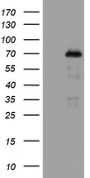 NUMB Antibody - HEK293T cells were transfected with the pCMV6-ENTRY control (Left lane) or pCMV6-ENTRY NUMB (Right lane) cDNA for 48 hrs and lysed. Equivalent amounts of cell lysates (5 ug per lane) were separated by SDS-PAGE and immunoblotted with anti-NUMB.