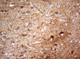 NUMB Antibody - IHC of paraffin-embedded Human adult heart tissue using anti-NUMB mouse monoclonal antibody. (Heat-induced epitope retrieval by 10mM citric buffer, pH6.0, 120°C for 3min).