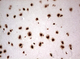 NUMB Antibody - IHC of paraffin-embedded Human adult brain tissue using anti-NUMB mouse monoclonal antibody. (Heat-induced epitope retrieval by 10mM citric buffer, pH6.0, 120°C for 3min).
