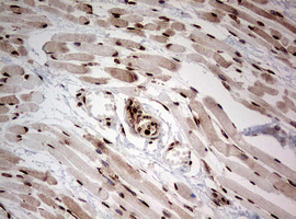 NUMB Antibody - IHC of paraffin-embedded Human muscle tissue using anti-NUMB mouse monoclonal antibody. (Heat-induced epitope retrieval by 10mM citric buffer, pH6.0, 120°C for 3min).