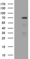 NUMB Antibody - HEK293T cells were transfected with the pCMV6-ENTRY control (Left lane) or pCMV6-ENTRY NUMB (Right lane) cDNA for 48 hrs and lysed. Equivalent amounts of cell lysates (5 ug per lane) were separated by SDS-PAGE and immunoblotted with anti-NUMB.