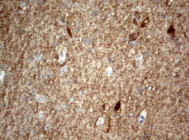 NUMB Antibody - IHC of paraffin-embedded Human adult heart tissue using anti-NUMB mouse monoclonal antibody. (Heat-induced epitope retrieval by 10mM citric buffer, pH6.0, 120°C for 3min).