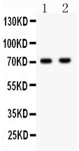 NUMB Antibody - NUMB antibody Western blot. All lanes: Anti NUMB at 0.5 ug/ml. Lane 1: U87 Whole Cell Lysate at 40 ug. Lane 2: NEURO Whole Cell Lysate at 40 ug. Predicted band size: 71 kD. Observed band size: 71 kD.