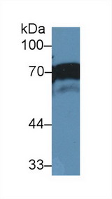 NUMB Antibody - Western Blot; Sample: Human A431 cell lysate; Primary Ab: 2µg/ml Rabbit Anti-Human NUMB Antibody Second Ab: 0.2µg/mL HRP-Linked Caprine Anti-Rabbit IgG Polyclonal Antibody