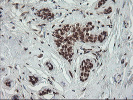 NUMB Antibody - IHC of paraffin-embedded Human breast tissue using anti-NUMB mouse monoclonal antibody.