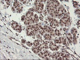 NUMB Antibody - IHC of paraffin-embedded Human pancreas tissue using anti-NUMB mouse monoclonal antibody.