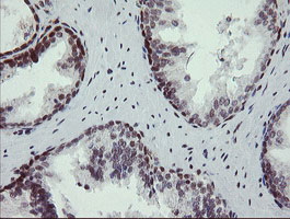 NUMB Antibody - IHC of paraffin-embedded Human prostate tissue using anti-NUMB mouse monoclonal antibody.