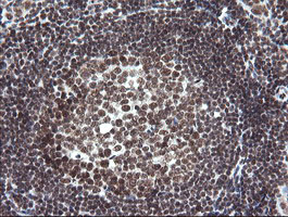 NUMB Antibody - IHC of paraffin-embedded Human tonsil using anti-NUMB mouse monoclonal antibody.